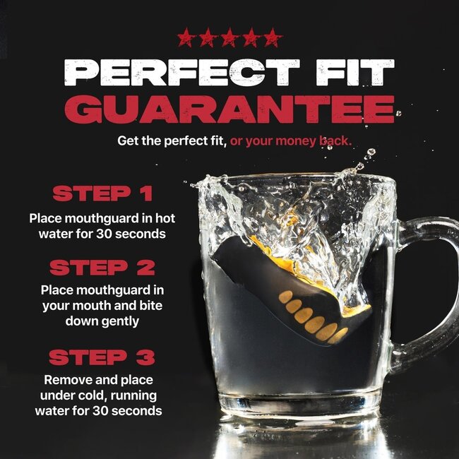 safe jaws SAFEJAWZ EXTRO - GEBITSBESCHERMING -  GOLDIE