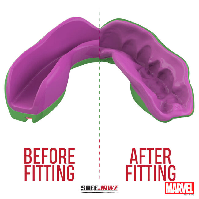 safe jaws SAFEJAWZ MARVEL™  - GEBITBESCHERMING SMASH - THE HULK