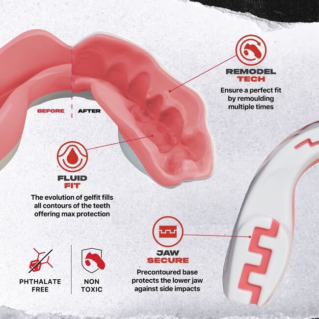 safe jaws Extro Fangs Gebitsbeschermer – Roze/Wit