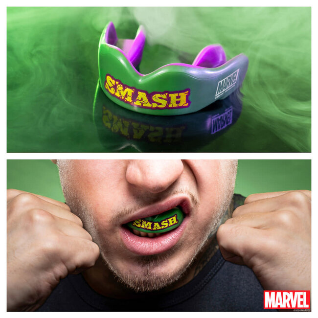 safe jaws Marvel The Hulk SMASH gebitsbeschermer – 12+