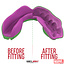 safe jaws Marvel The Hulk SMASH gebitsbeschermer – 12+