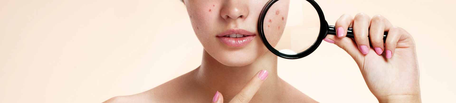 6 valse mythes over een vette huid