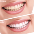 Natural Teeth Whitening - Tandenbleekset - Inclusief 1 Bamboe Tandenborstel
