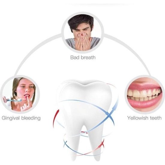 U-Tandenborstel/ U-Smart Toothbrush/ 360 Graden Intelligente Automatische Sonische Elektrische Tandenborstel