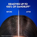 Head & Shoulders Head & Shoulders Shampoo - Menthol Fresh - 360ml