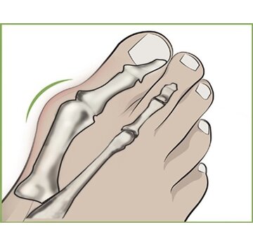 Generic Generic - Écarteur d'orteil Hallux Valgus