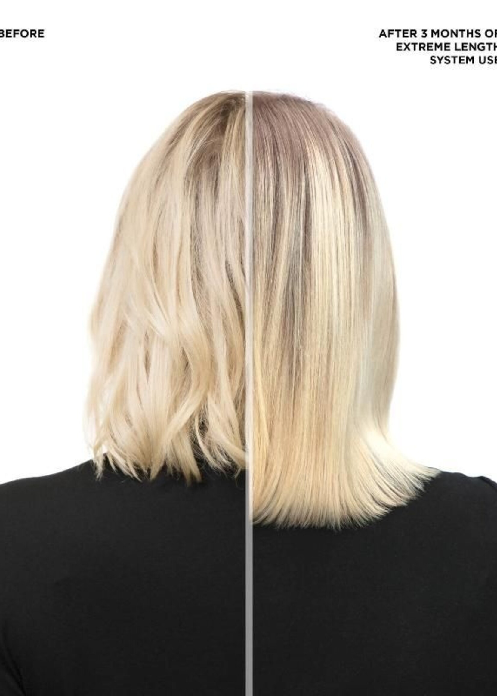 Redken Redken Extreme Length With Biotin - Set 2x300ml