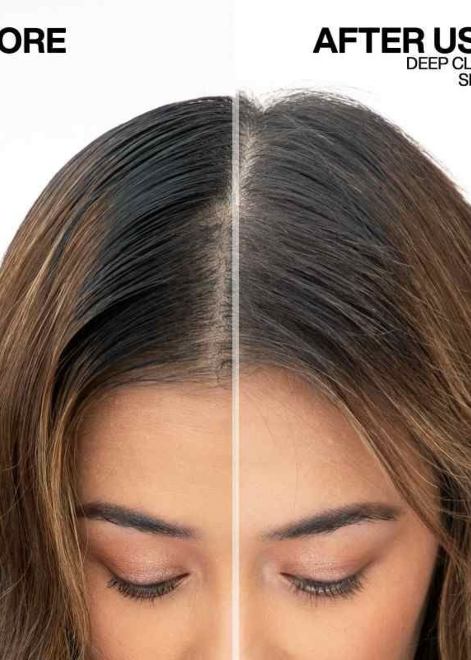 Redken Redken Deep Clean Dry Shampoo Maximum Oil Absorption - 150ml (91gr)