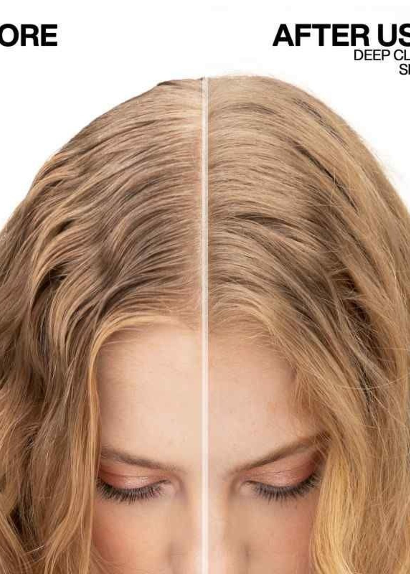 Redken Redken Deep Clean Dry Shampoo Maximum Oil Absorption - 150ml (91gr)