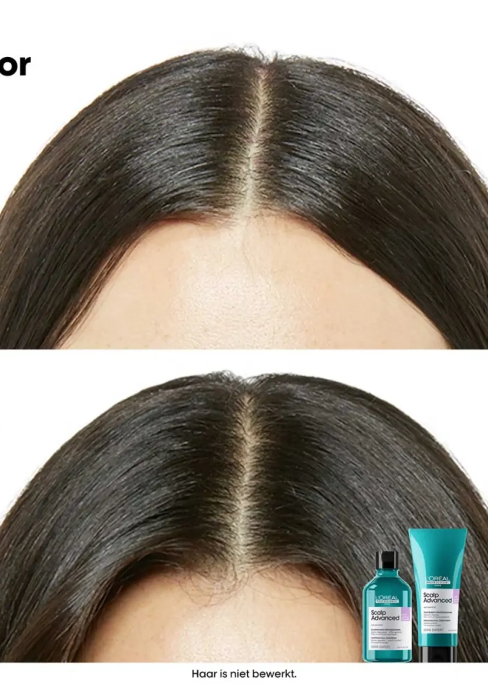 L'Oreal Professionnel L'Oreal SE Scalp Advanced Anti-Discomfort Shampoo Refill - 500ml