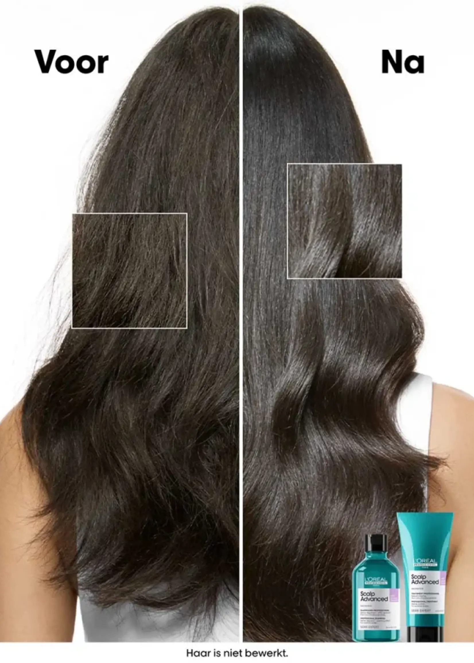 L'Oreal Professionnel L'Oreal SE Scalp Advanced Anti-Discomfort Shampoo Refill - 500ml