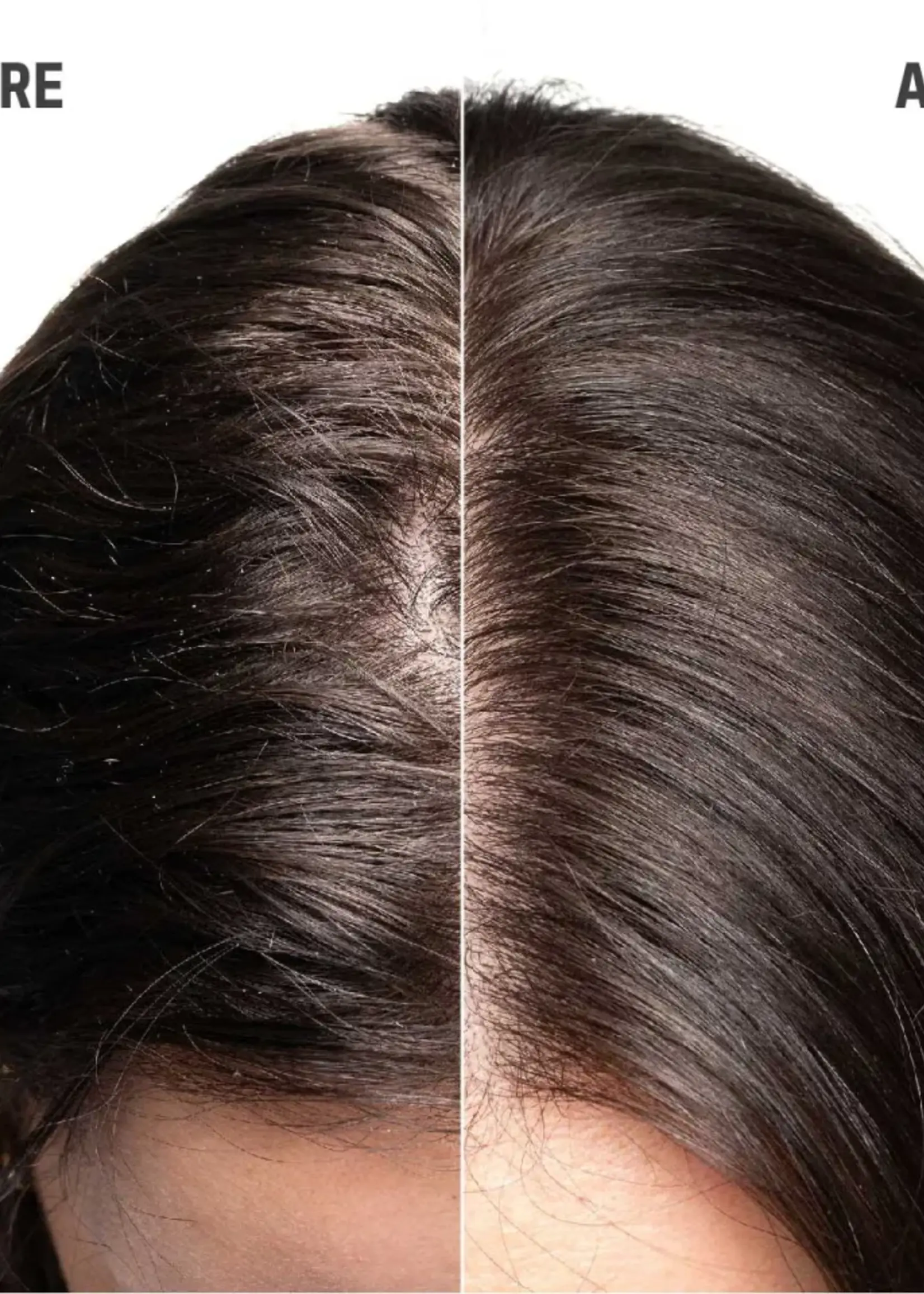 Goldwell Goldwell Dualsenses Scalp Specialist Scalp Rebalance & Hydrate Fluid - 150 ml