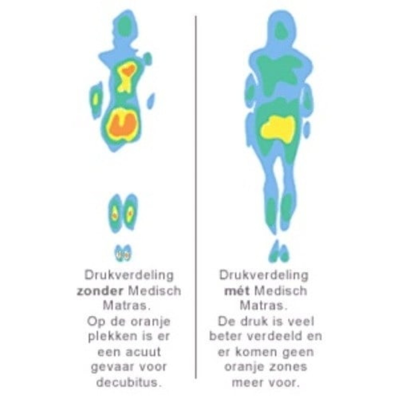 Topdekmatras Traagshuim