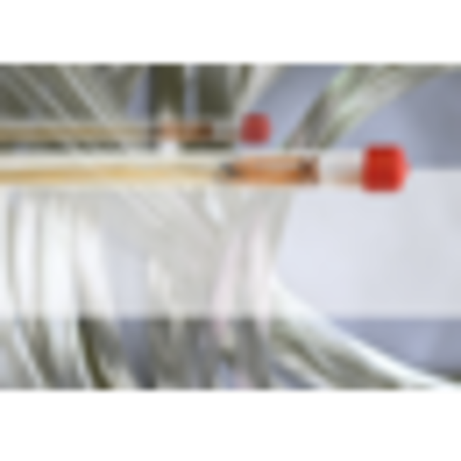 Il Canonne  cellostrings