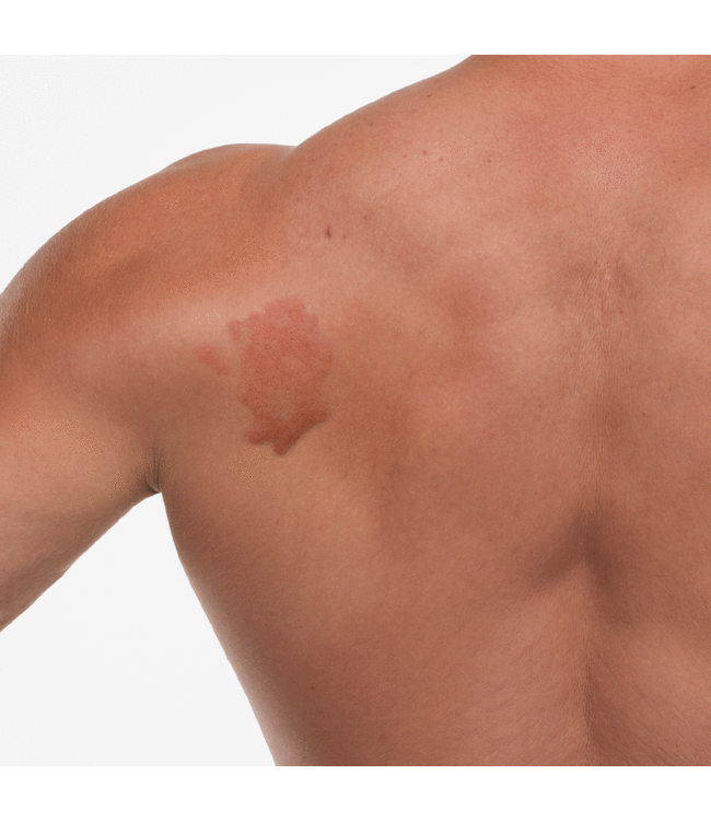 Gentlehomme HOCL Facial Spray