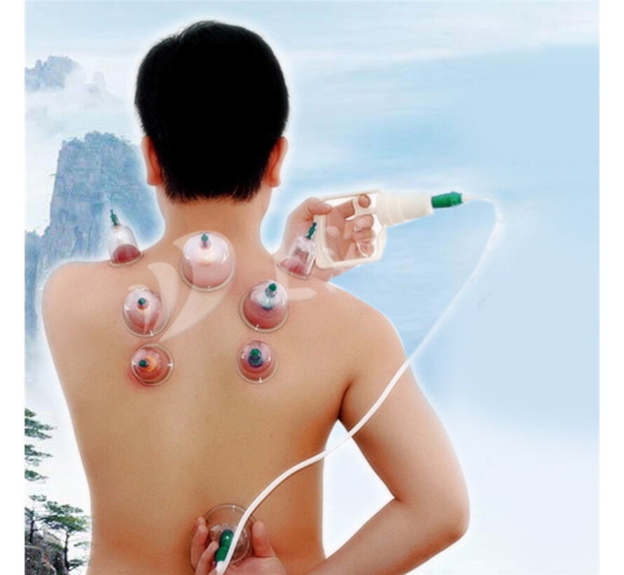 Allernieuwste.nl® Cupping Set 12-Delig - Cellulite Cups - Vacuüm Massage Cups - Massage Cups - Anti Cellulitis behandeling - Cupping Therapy