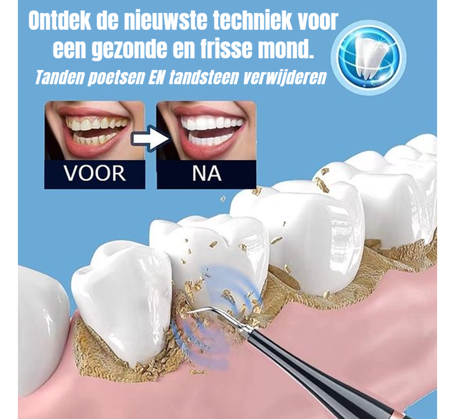 Allernieuwste.nl® SET Oplaadbare Sonische Tandenborstel PLUS Tandsteenverwijderaar - Ultrasone Tandenbostel Tandsteen Verwijderen 5 standen 31000/min - Kleur Zwart ##