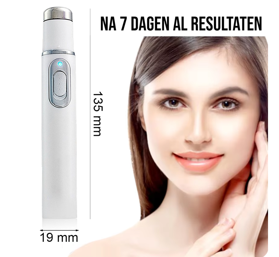 Allernieuwste.nl® Blauwe Licht Gezicht Laserpen - Acne & Rimpel Verwijdering + Huidverjonging ##