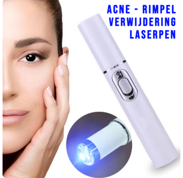 Allernieuwste.nl Blauwe Licht Gezicht Laserpen - Acne & Rimpel Verwijdering