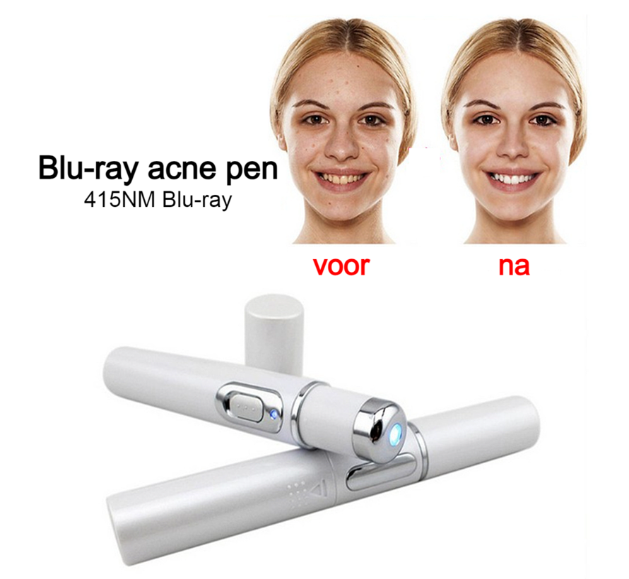 Allernieuwste.nl® Blauwe Licht Gezicht Laserpen - Acne & Rimpel Verwijdering + Huidverjonging ##