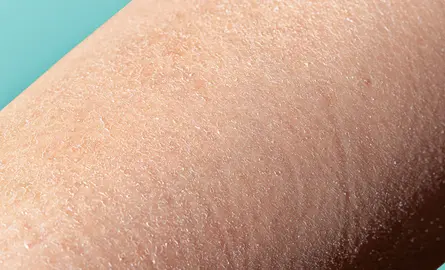 Waarom een goede bodylotion belangrijk is