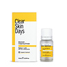 ClearSkinDays ClearSkinDays Acne Clearing Drops ClearSkinDays ClearSkinDays Acne Clearing Drops