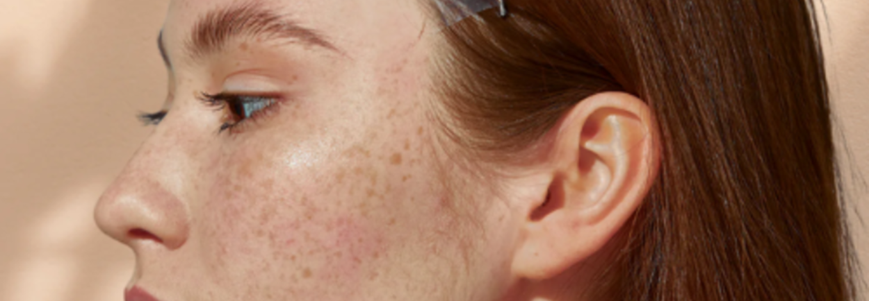 Een facelift zonder chirurgie? Zo werkt het.