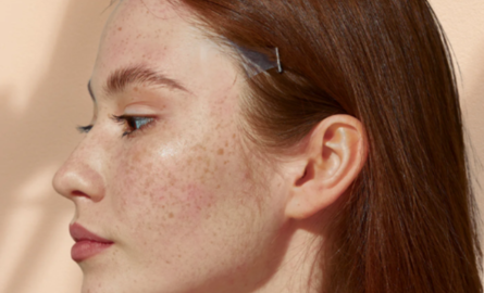 Een facelift zonder chirurgie? Zo werkt het.