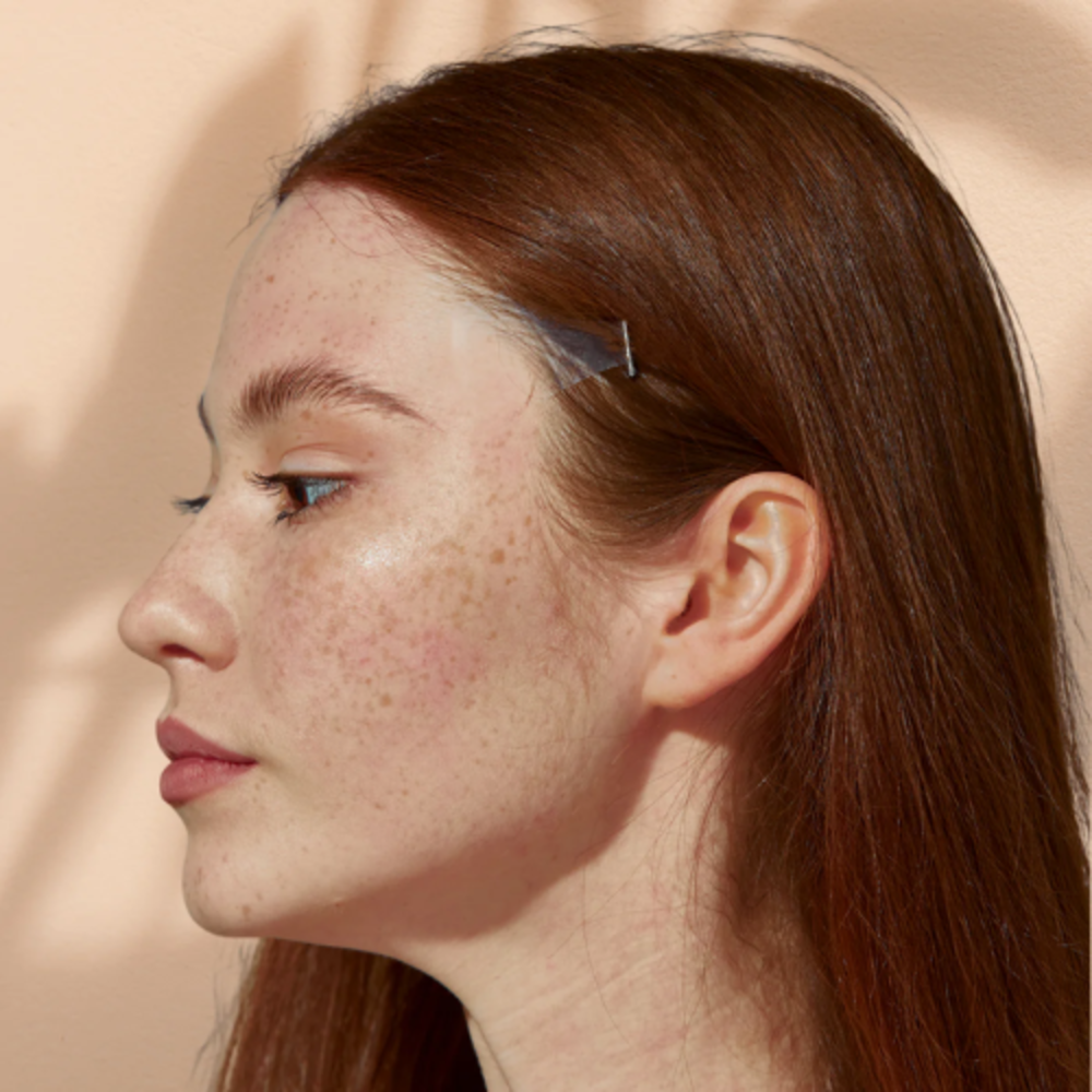 Een facelift zonder chirurgie? Zo werkt het.