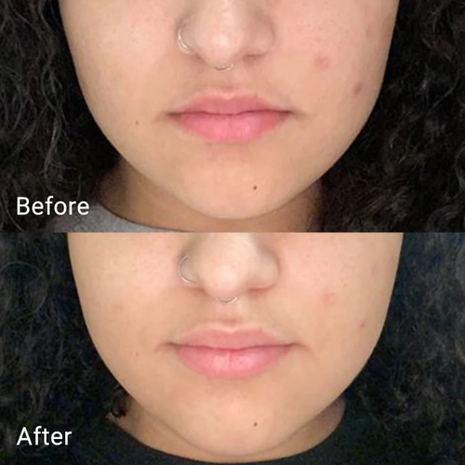 APRILSKIN APRILSKIN Real Calendula Peel Off Pack APRILSKIN APRILSKIN Real Calendula Peel Off Pack