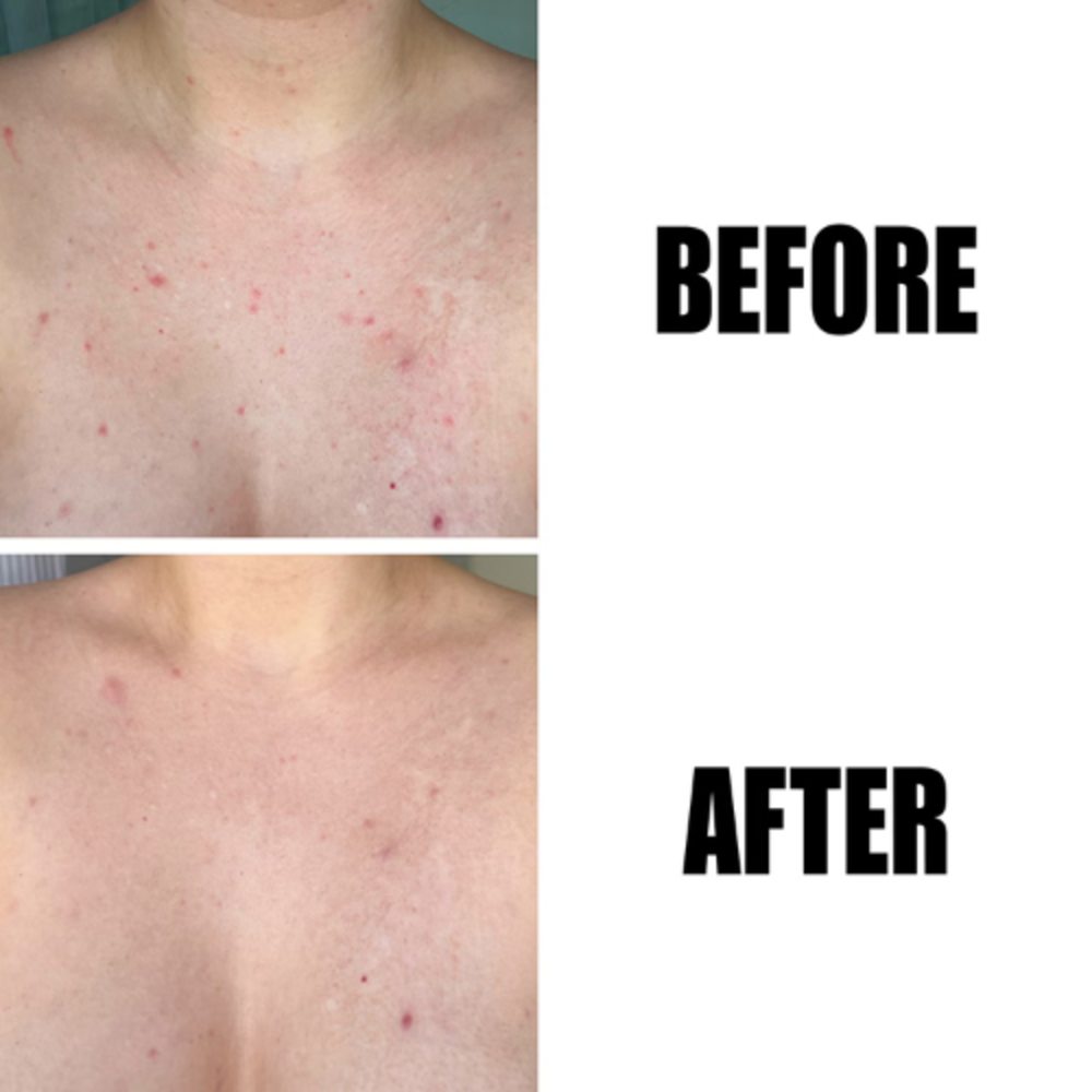 The Inkey List The Inkey List Glycolic Acid Exfoliating Body Stick