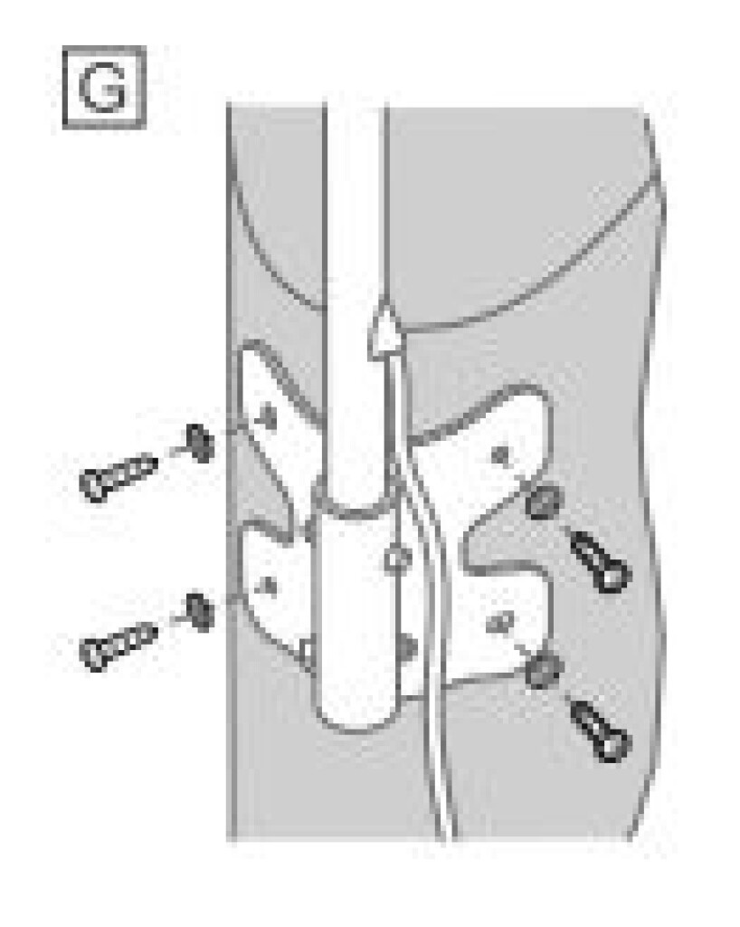 Veratron VDO Top mast - Front Bracket
