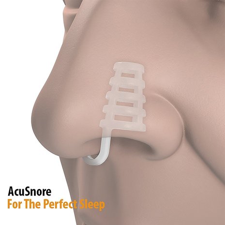 Acusnore Acusnore Air Flow Nose Vents - Single Pack - Extra Small Acusnore Acusnore Air Flow Nose Vents - Single Pack - Extra Small
