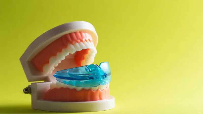  Aangepaste Snurkbeugels voor Kunstgebitdragers: 