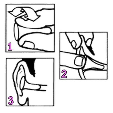 Bilsom 303 Oordoppen (5 sets) Bilsom 303 Oordoppen (5 sets)