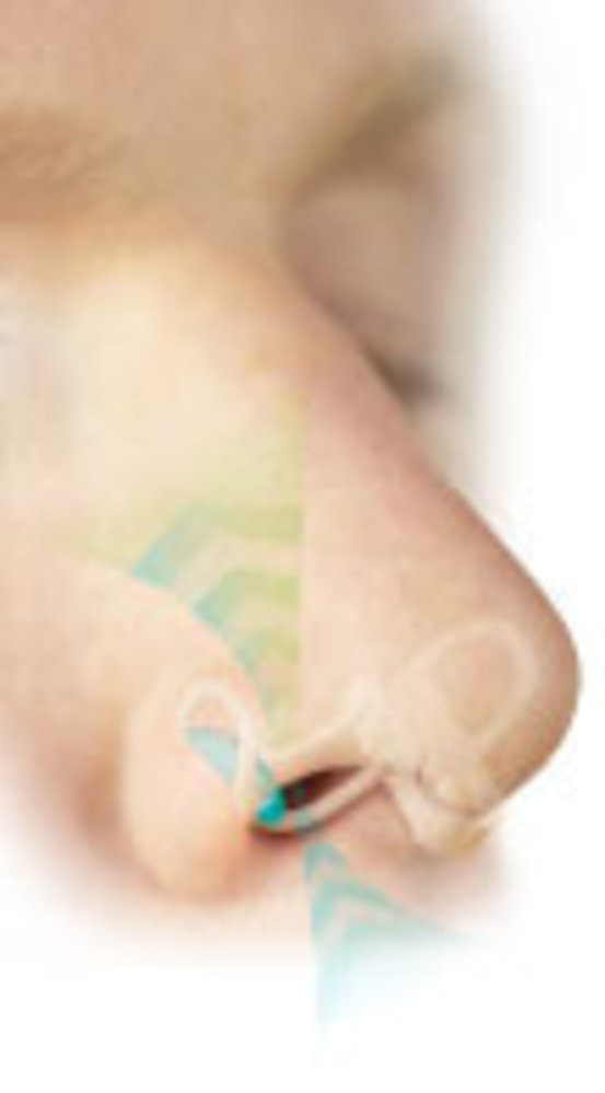 SleepRight Neusspreider Intra-Nasal Sleep Inhaler SleepRight Neusspreider Intra-Nasal Sleep Inhaler