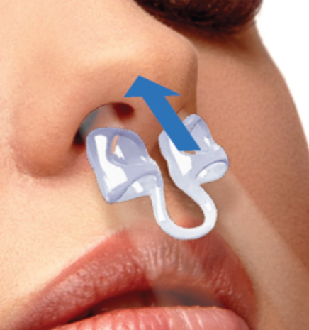 SleepPro  Neusspreider - Neusdilatator  - 3 stuks