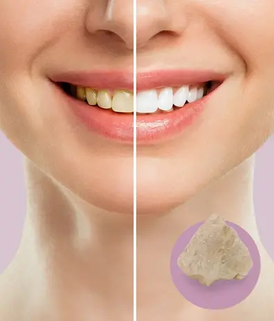 Dr. Wild Depurdent Clean & Polish tandpasta – Natuurlijk wittere tanden Dr. Wild Depurdent Clean & Polish tandpasta – Natuurlijk wittere tanden