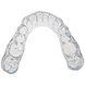 SleepPro Bleekbitje op Maat – Teeth Whitening Custom SleepPro Bleekbitje op Maat – Teeth Whitening Custom