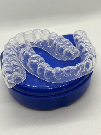 SleepPro  SleepPro Bleekbitje op Maat – Teeth Whitening Custom (zonder gel)