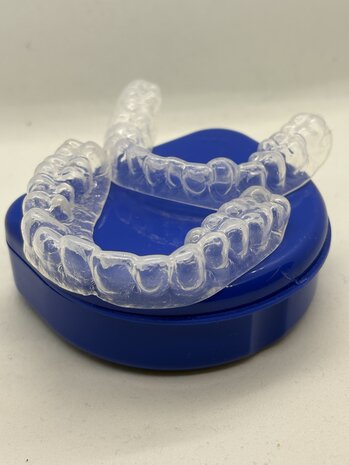 SleepPro  SleepPro Bleekbitje op Maat – Teeth Whitening Custom (zonder gel)