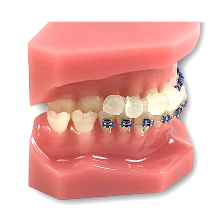 GUM Orthodontisches Wachs für Zahnspangen GUM Sunstar GUM Orthodontisches Wachs für Zahnspangen