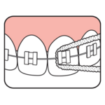 TePe Bridge & Implant Floss - 30 Stück Tepe TePe Bridge & Implant Floss - 30 Stück
