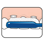 TePe Implant Orthodontic Zahnbürste Tepe TePe Implant Orthodontic Zahnbürste
