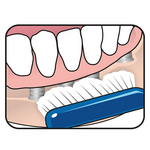 TePe Implant Orthodontic Zahnbürste Tepe TePe Implant Orthodontic Zahnbürste