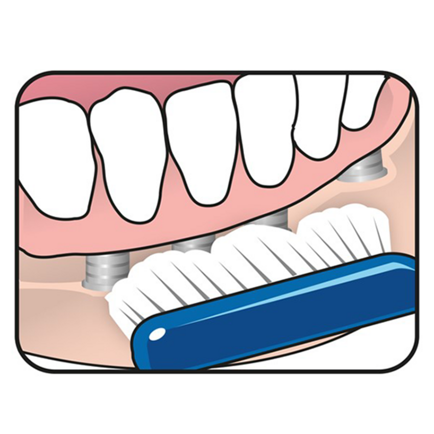 TePe Implant Orthodontic Zahnbürste Tepe TePe Implant Orthodontic Zahnbürste