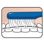 TePe Implant Orthodontic Zahnbürste Tepe TePe Implant Orthodontic Zahnbürste