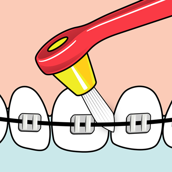 Tepe TePe Interspace Soft Zahnbürste (inkl. 12 Spitzen)