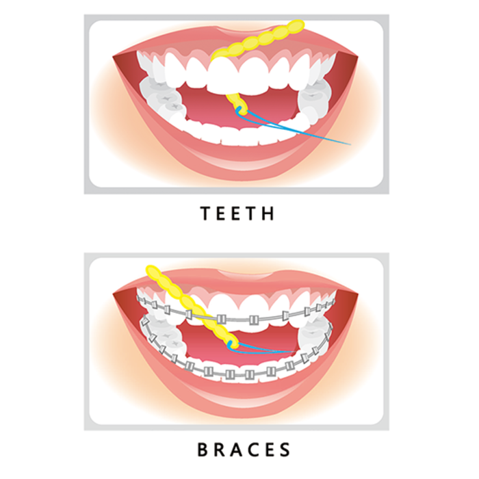 iDONTIX iDontix X-Flossthinner - 10 Stück
