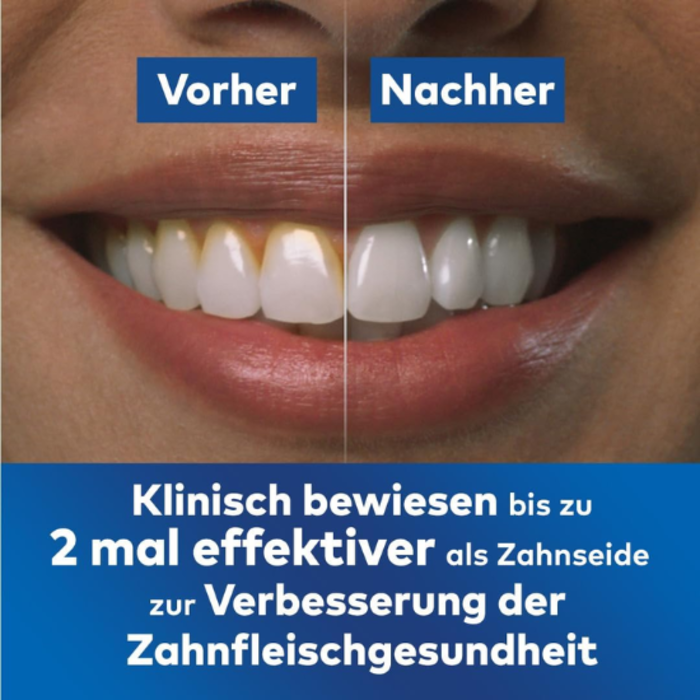 Waterpik Waterpik WP-580 Advanced Waterflosser Kabellos Weiß